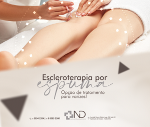 Escleroterapia por espuma