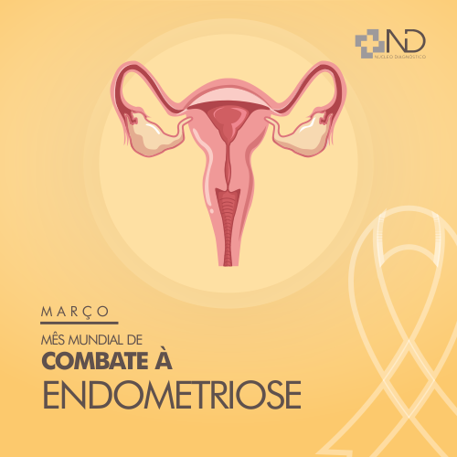 Março é o Mês Mundial de Conscientização da Endometriose