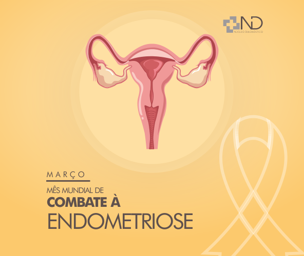 Março é o Mês Mundial de Conscientização da Endometriose