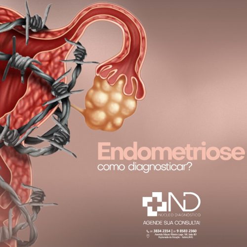 Endometriose como diagnosticar?