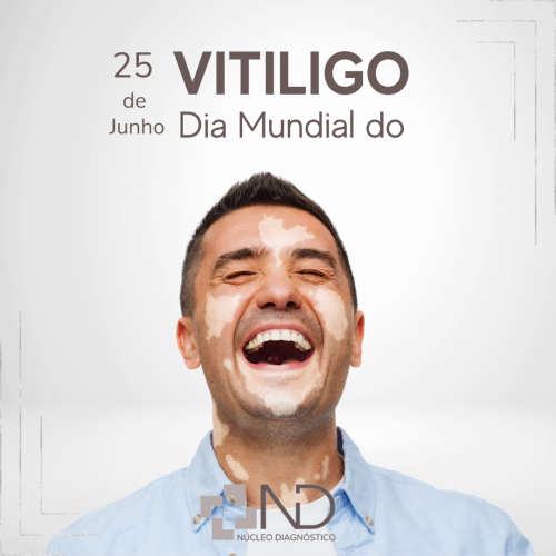 Dia Mundial do Vitiligo